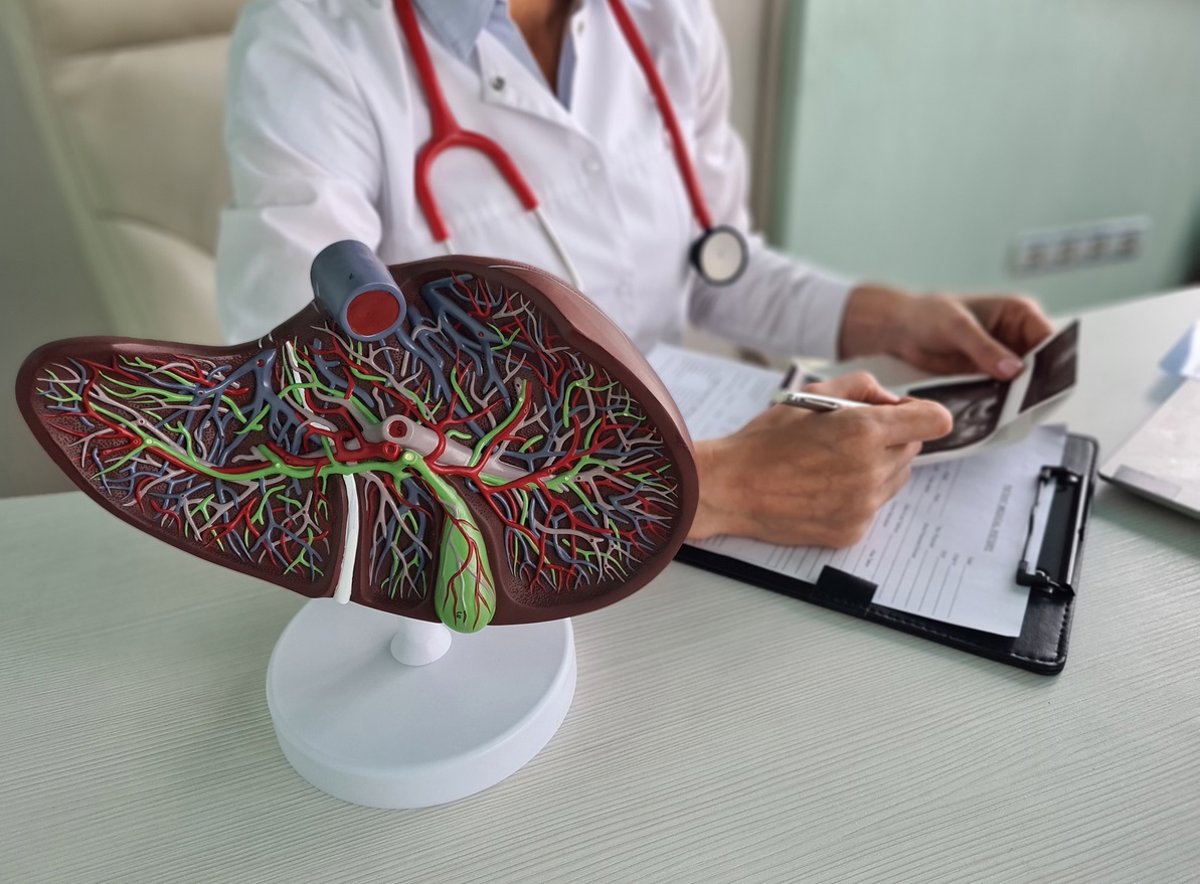 Un avance clave en el tratamiento de la fibrosis hepática